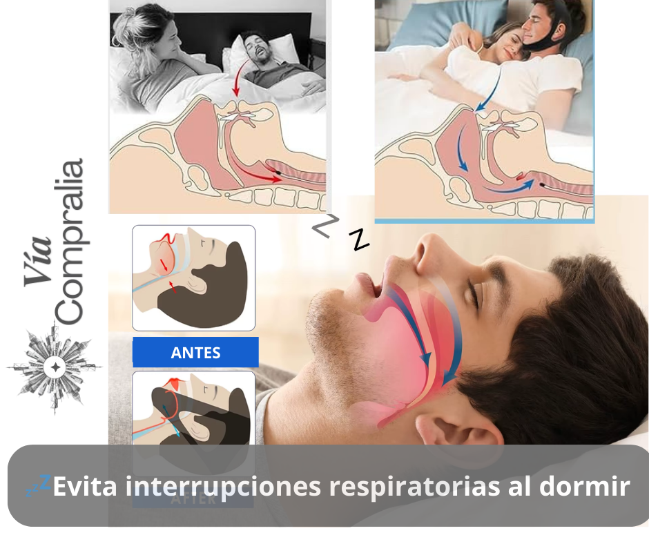 😴Banda Unisex Anti Ronquidos Para Barbilla