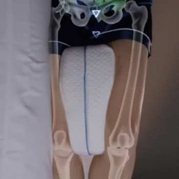 🛌 Almohada Ortopédica - Alinea Piernas y Columna - Duerme Sin Dolor Desde la Primera Noche